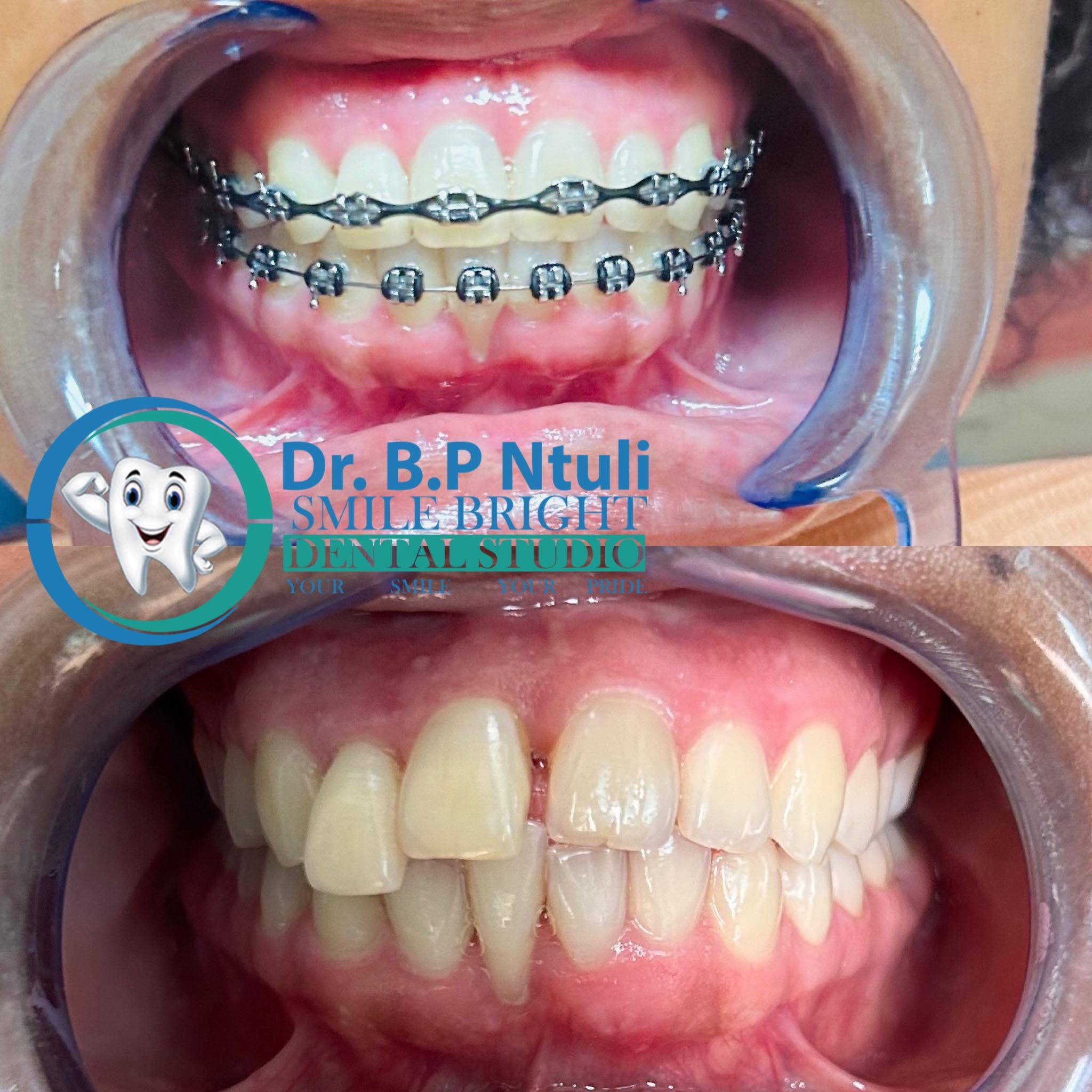Patient with a bright, healthy smile